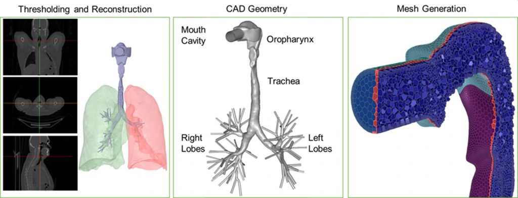 人の肺のモデリング（3Dスキャン、CADデータ化、CFDメッシュ作成）