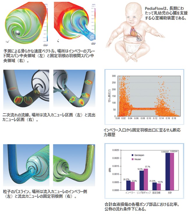 予測による滑らかな速度ベクトルの図、​二次流れの流線の図、粒子のパスラインの図、インペラー入口から固定羽根出口に至るせん断応力履歴の図、合計血液損傷の各種ポンプ部品における比率の図