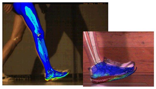 歩行と筋肉の応力解析（整形外科分野）​