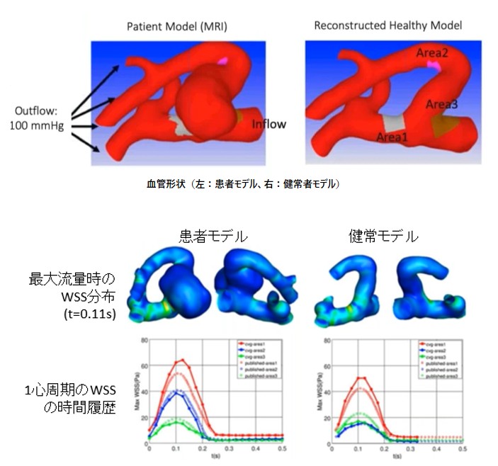 図：頭蓋内動脈瘤のリスク評価